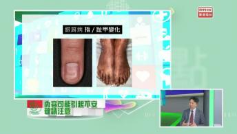 香港皮膚健康基金系列 - 如何分辨濕疹與銀屑病