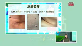 皮膚良性與惡性增生