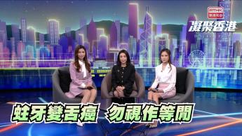 第948集 不時輕視蛀牙，隨時引發舌癌！